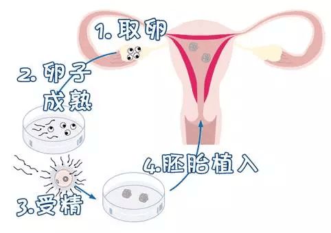 验孕棒