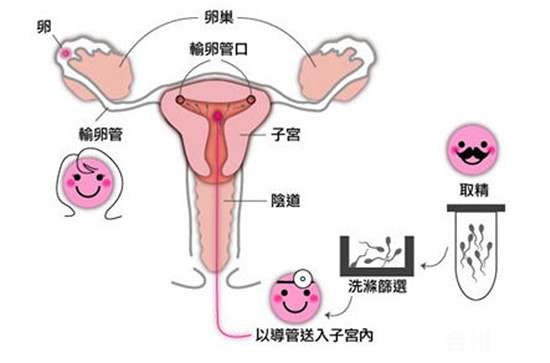 飞机辐射