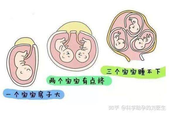 飞机