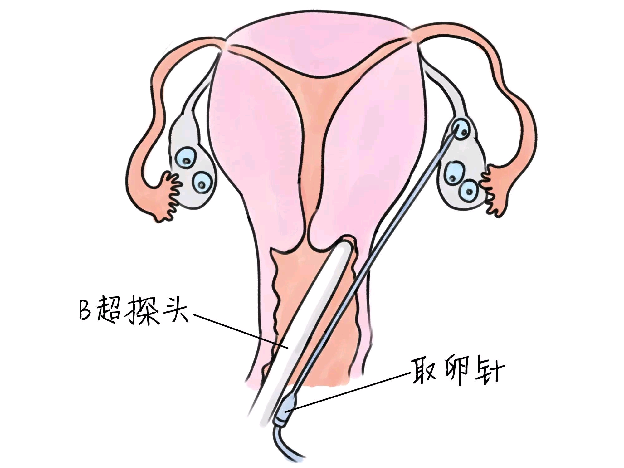 预测胎儿体重计算器在线