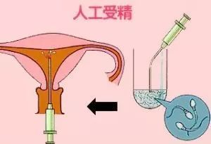 飞机辐射