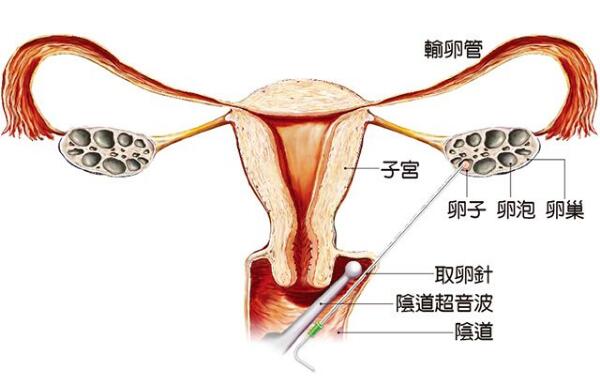 验孕棒一深一浅