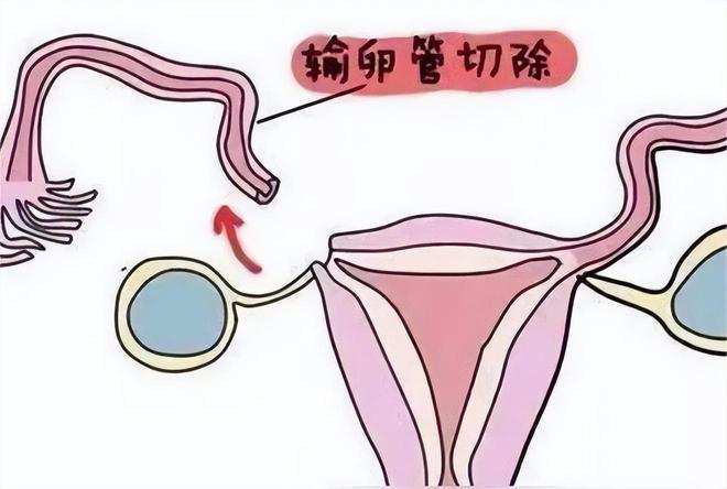 验孕棒