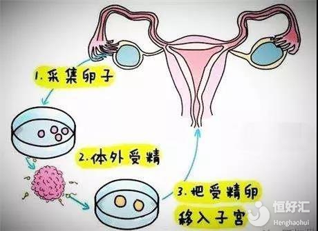 验孕棒